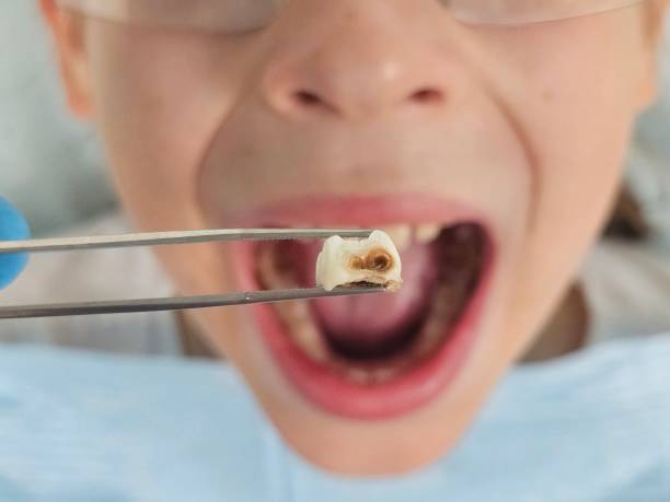 Best Orthodontic Emergency Dentist in Dale City, VA